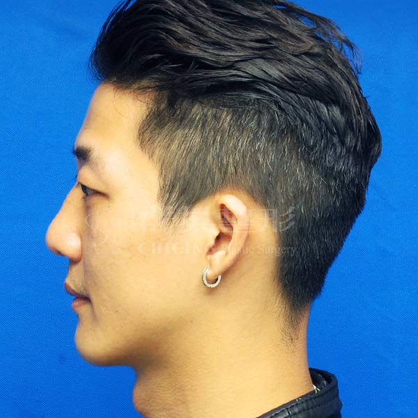 After-CASE02-3