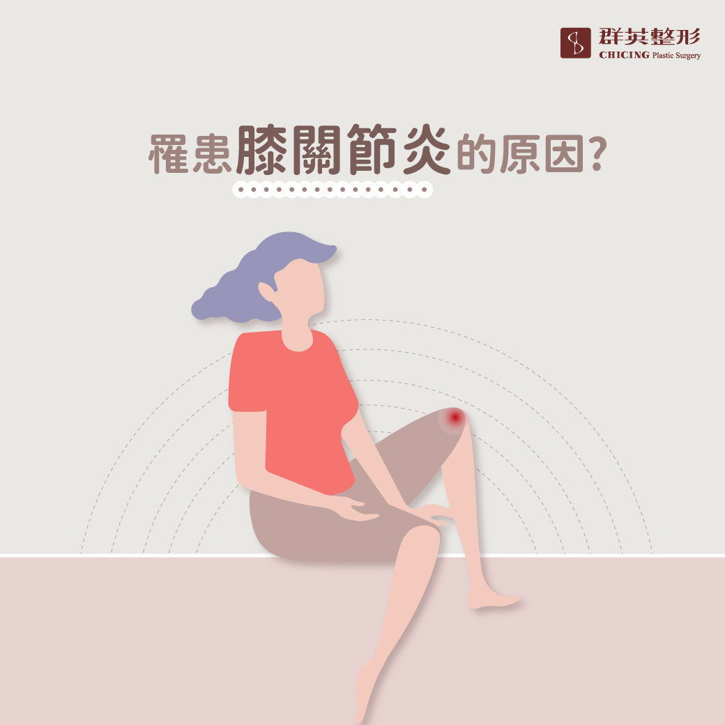 沈慶源醫師專欄膝關節退化