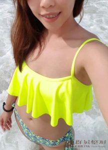 陳廣得醫師_魔滴隆乳案例