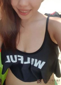 陳廣得醫師_魔滴隆乳案例