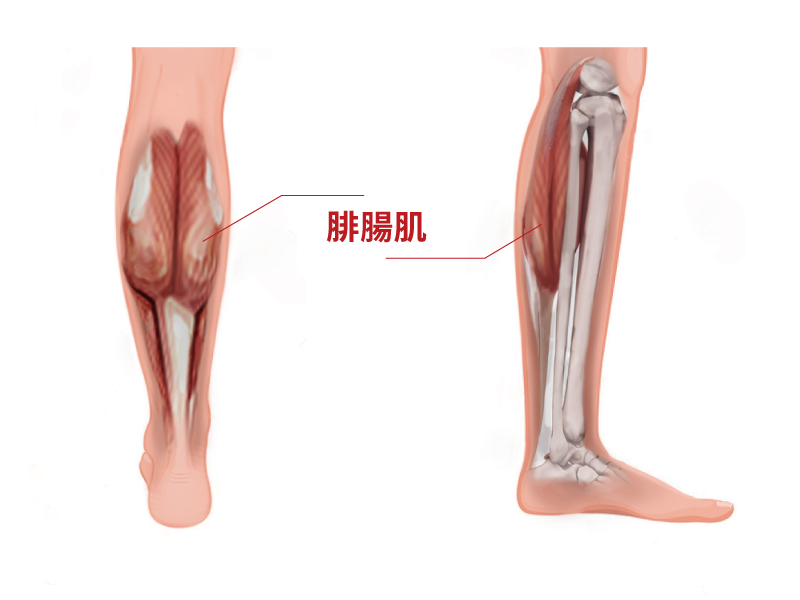 陳廣得醫師_小腿神經截斷術