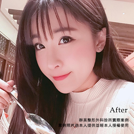 陈怡杰医师_台湾台北_正颔手术