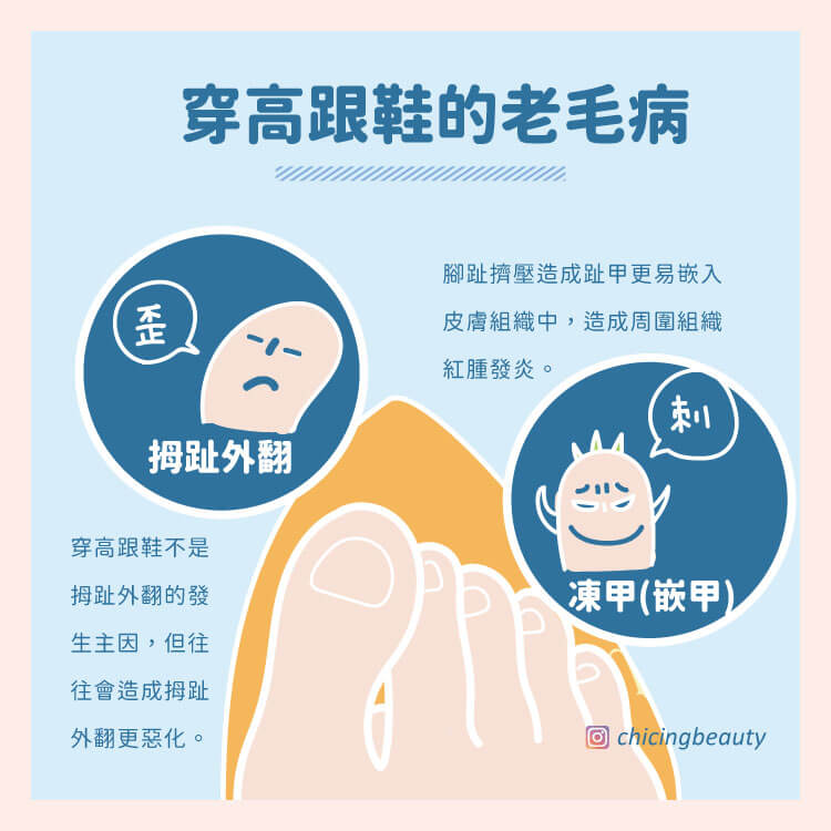 高跟鞋_拇指外翻_凍甲