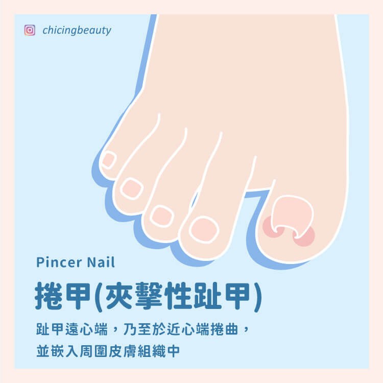 捲甲_陳建璋醫師_小黑醫師