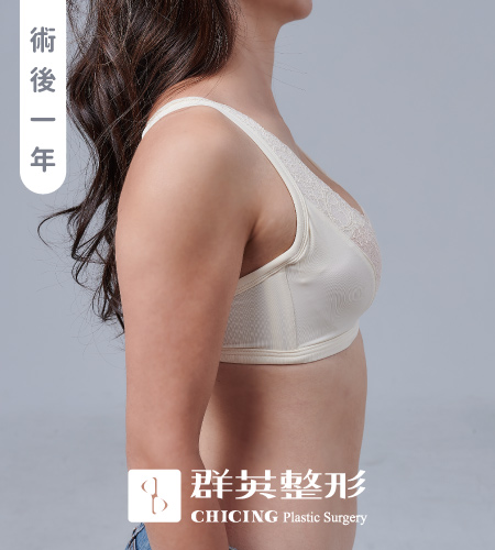 群英黃馨慧醫師_魔滴隆乳術後內衣照093012