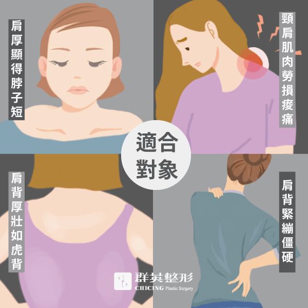 侯憲棋醫師_水牛肩如何變回天使肩?