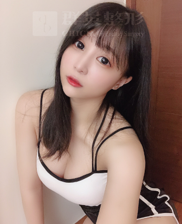台北群英_黃志宏醫師_魔滴隆乳29