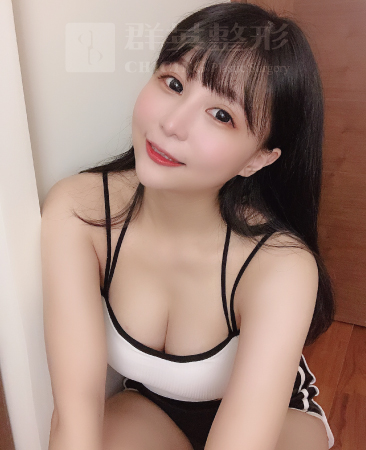台北群英_黃志宏醫師_魔滴隆乳28