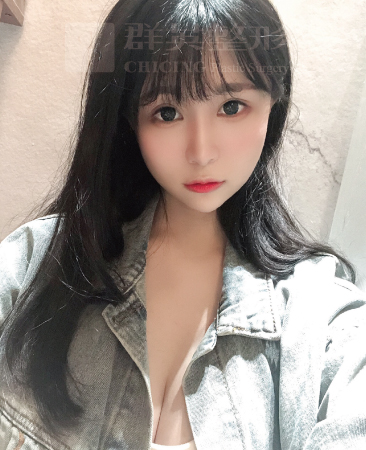 台北群英_黃志宏醫師_魔滴隆乳18