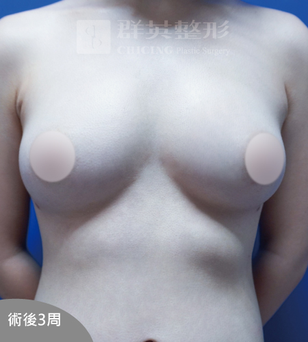 高雄抽脂豐胸_高雄群英_王冠穎醫師_15