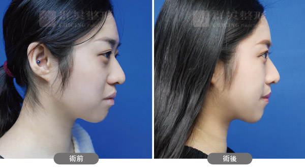 陳廣得醫師_複合式眼周治療