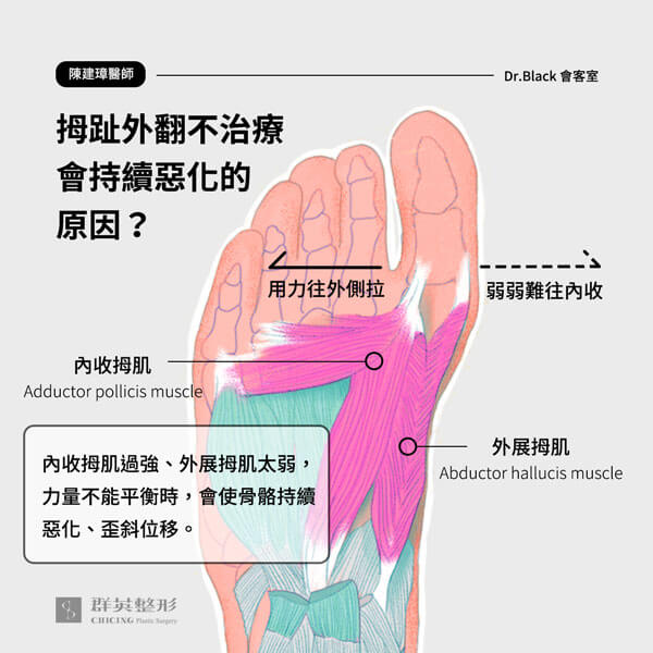 拇指外翻的原因