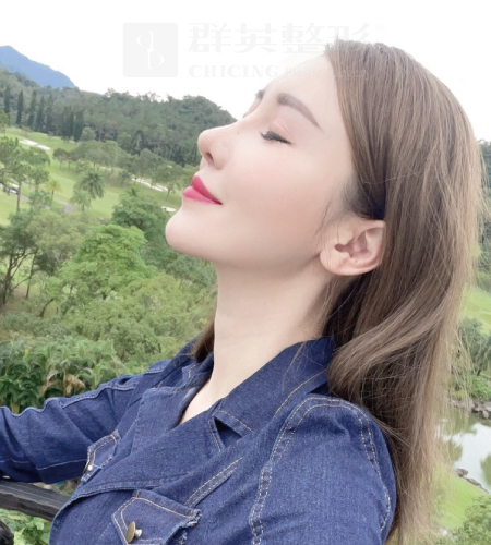 陳大正醫師_二次隆鼻_真實案例