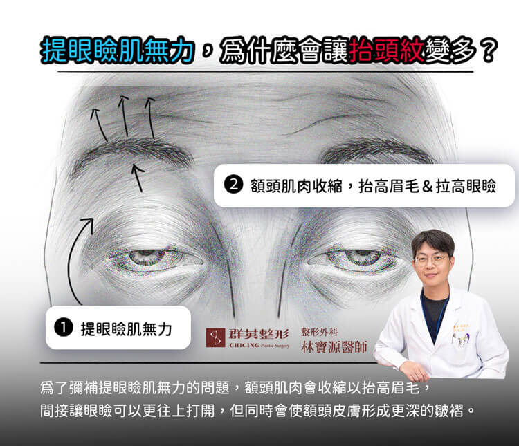 提眼瞼肌無力_為什麼讓抬頭紋變多