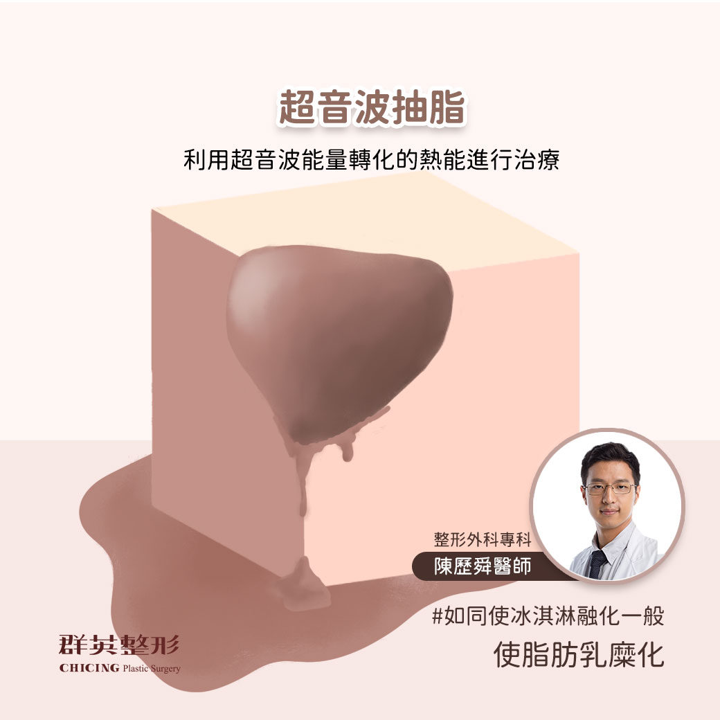 超音波抽脂_威塑_UltraZ抽脂_高雄整形_推薦_陳歷舜醫師