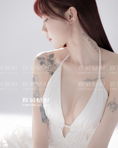 台中魔滴隆乳診所推薦群英醫美