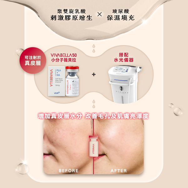 VIVABELLA 薇貝拉_魔法針_群英醫美_群英皮膚科08
