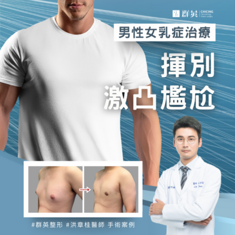 群英整形外科 洪章桂醫師 男性女乳症手術